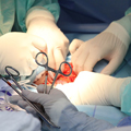 Surgery and Transplantation